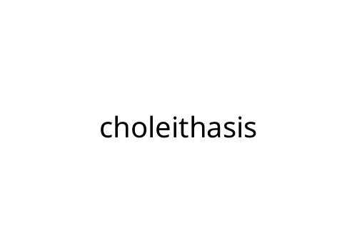 choleithasis